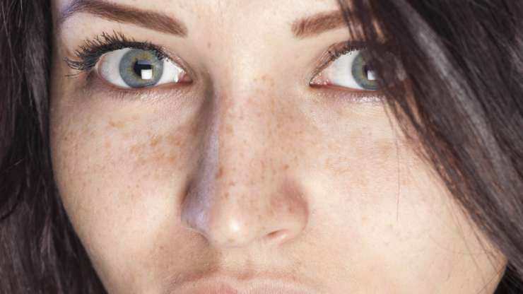 8 Dark Spot Treatments