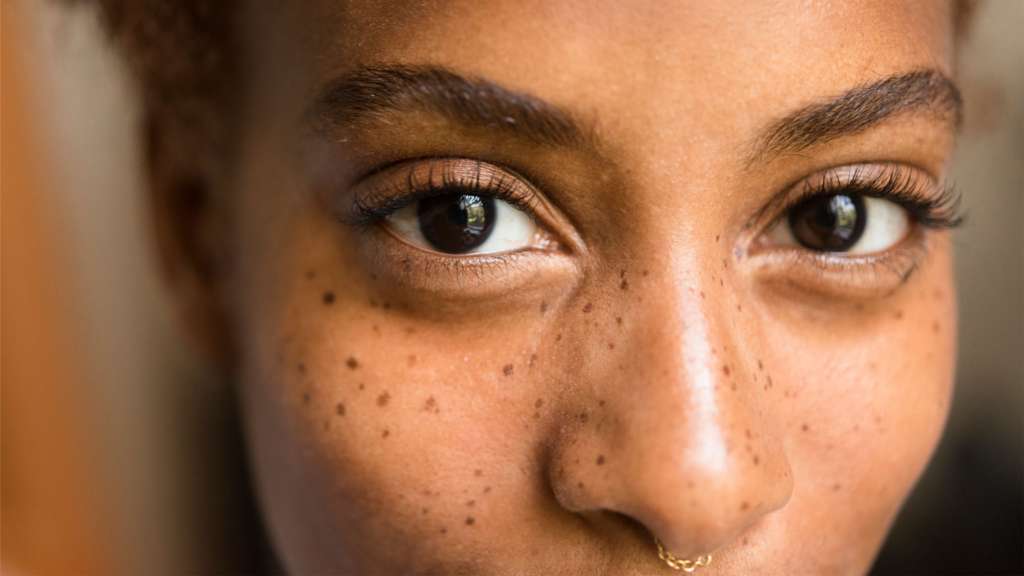 How do you lighten brown spots on your face? - SCULPTDTLA.COM