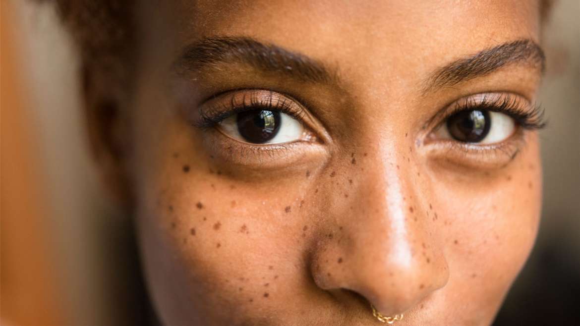 do you lighten brown spots on face? SCULPTDTLA.COM