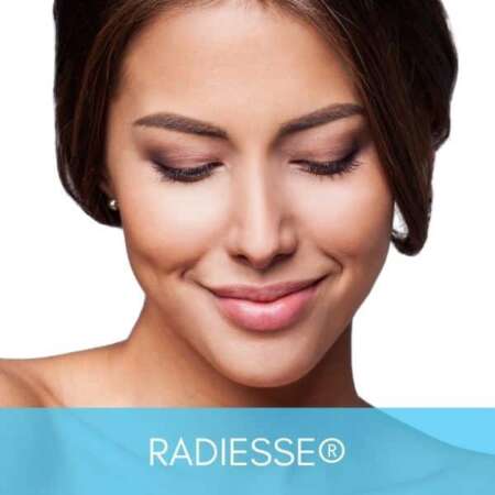 Woman smiling with smooth skin after Radiesse dermal filler injection to treat wrinkles and folds.