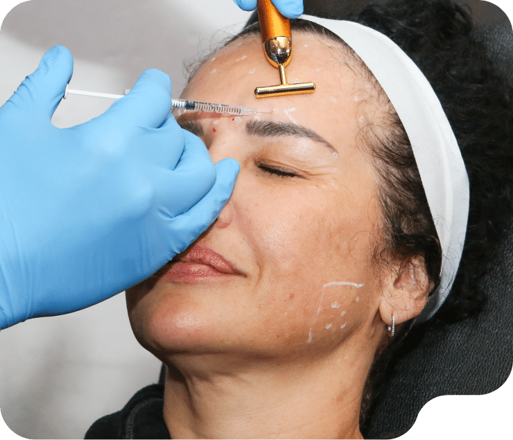 Xeomin: A Natural Approach to Wrinkle Reduction